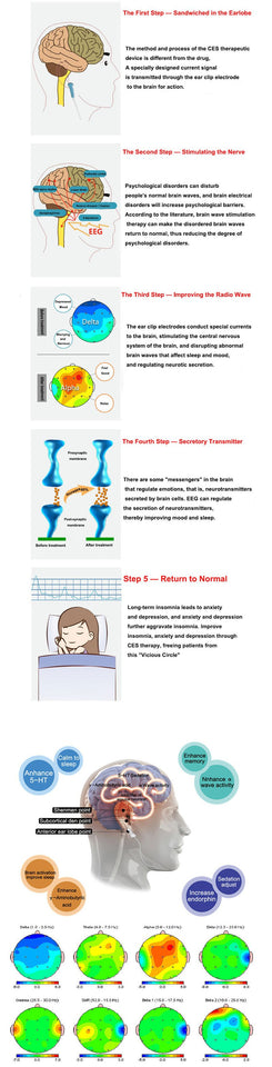 Electrotherapy CES Anti Insomnia Sleep Aid Device