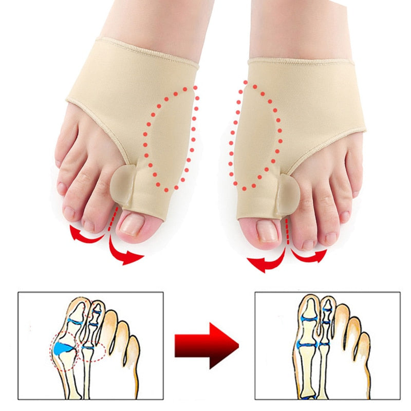 (1 Pair) Medical Bunion Corrector